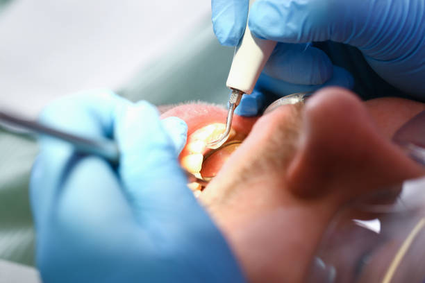 Best Urgent Care for Lost Fillings or Crowns in Mount Arlington, NJ