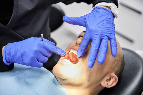 Best Emergency Dental Care for Broken or Chipped Teeth in Mount Arlington, NJ